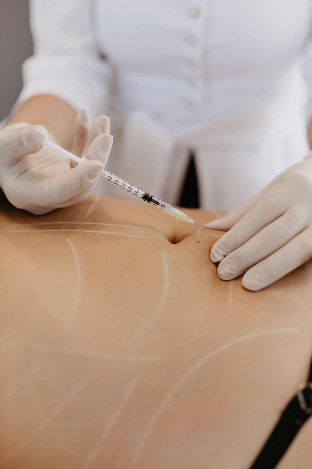 Bioestimulador