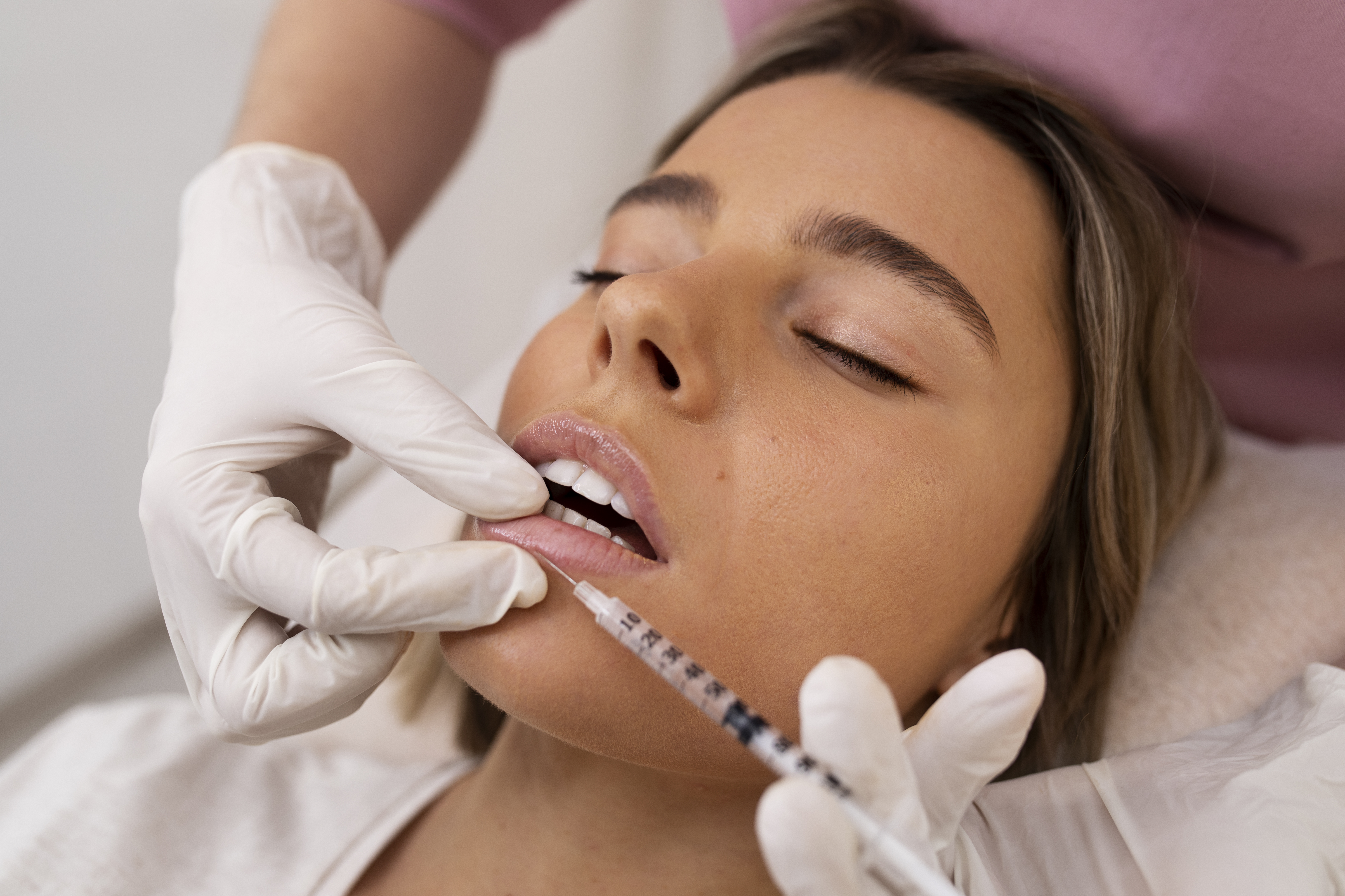 Preenchimento Labial